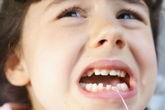 インビザラインが失敗